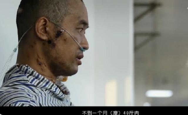 首批新冠幸存者：含泪捐献父亲遗体，20天抢救瘦了40斤