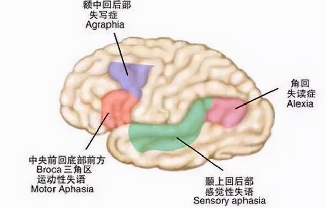 左撇子比右撇子更聪明？真相要比你所想的复杂多了
