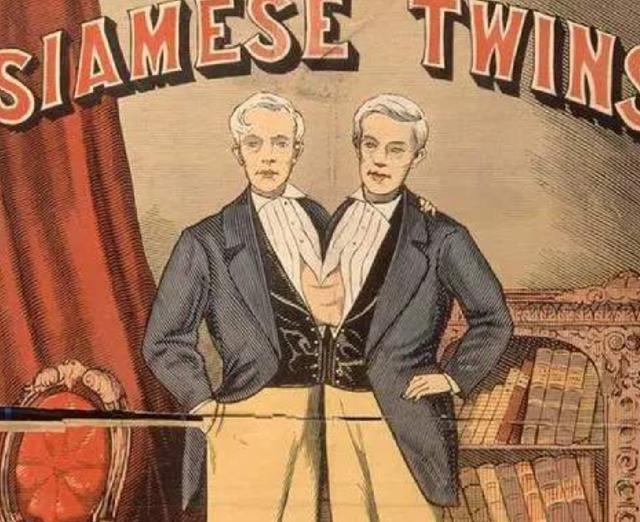 连体人为何会相连？如果将身体分离，还能存活下去吗？