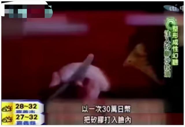 韩慧景：把自己整成“电风扇”，注射食用油代价惨痛，我悔不当初
