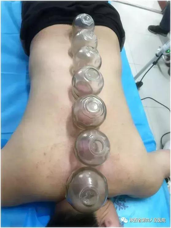 陕西省第四人民医院开展中医“治未病”诊疗服务