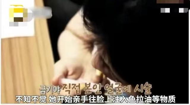 韩慧景：把自己整成“电风扇”，注射食用油代价惨痛，我悔不当初