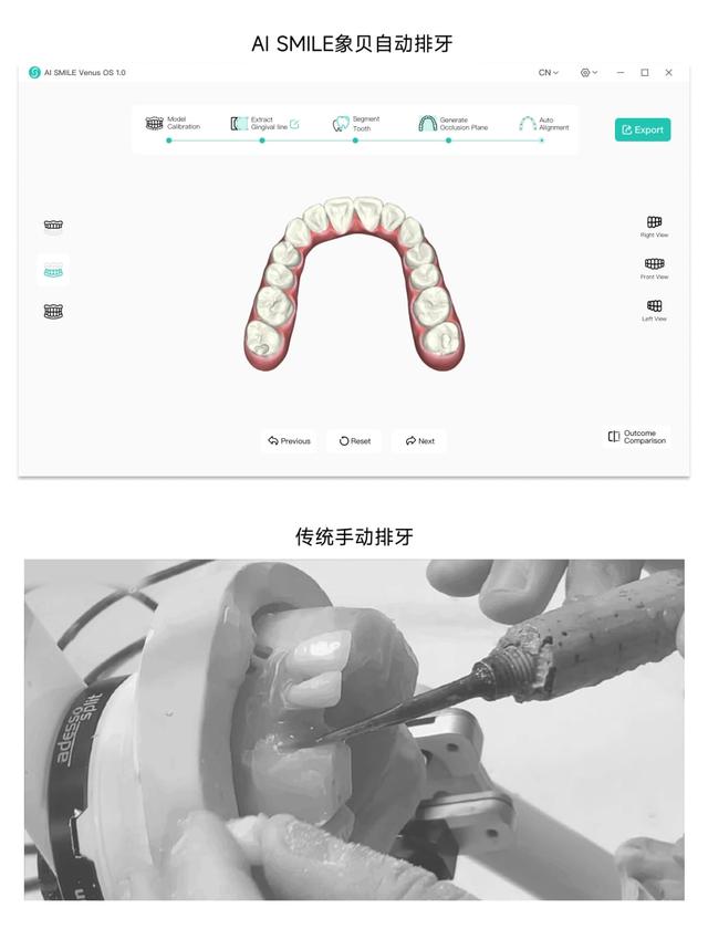 象贝AI正畸排牙系统Venus1.0发布 开辟数字化牙科新纪元