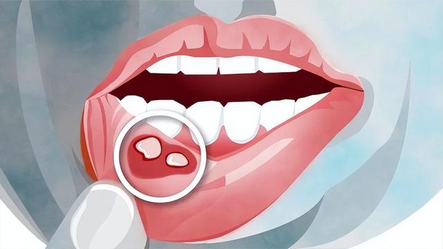维生素B2有何作用？坚持服用，身体会出现哪些变化呢？早看早了解