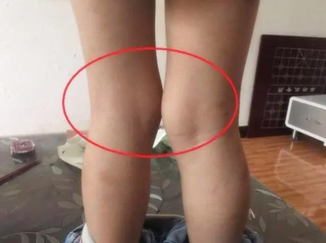 国内孩子的腿，为啥没国外孩子腿直？父母这种错误抱娃姿势是关键