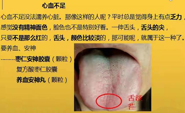 凌晨1—3点早醒，8种常见失眠类型，症状表现及实用中成药大总结