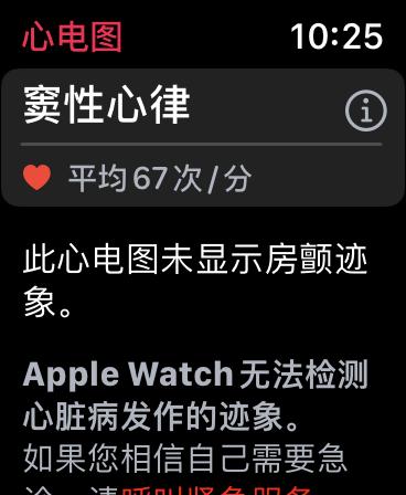 休闲玩家带你入坑：Apple Watch 6一年使用感受