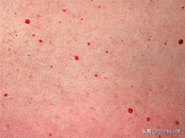 胳膊上好多小红点
