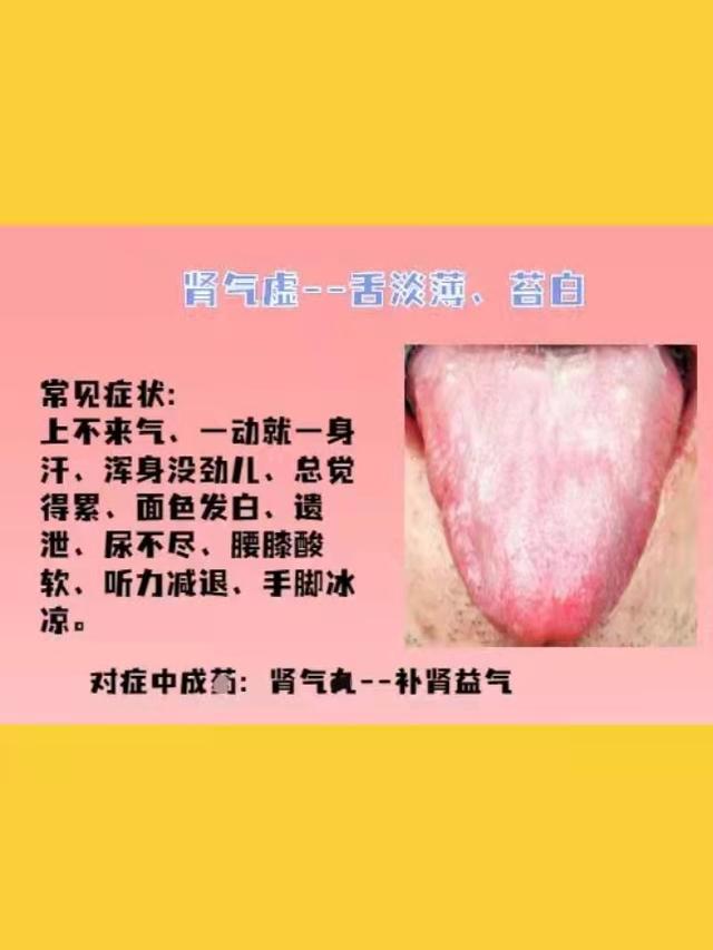 身体常见的几种虚证，建议了解