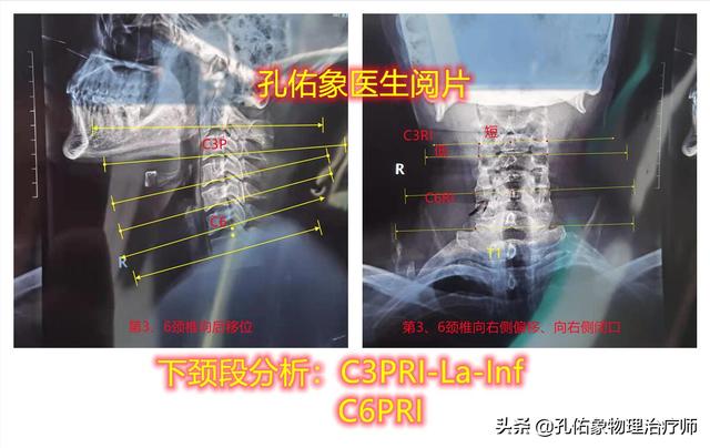 肩胛骨疼痛、手麻、整天头昏脑胀，是更年期综合症吗？不要被糊弄