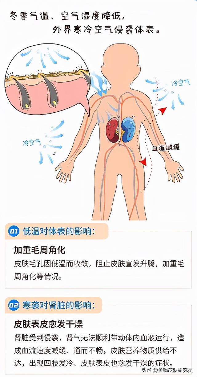 为什么鱼鳞病在冬天才有？鱼鳞皮肤冬季加重的原因，该怎么护理