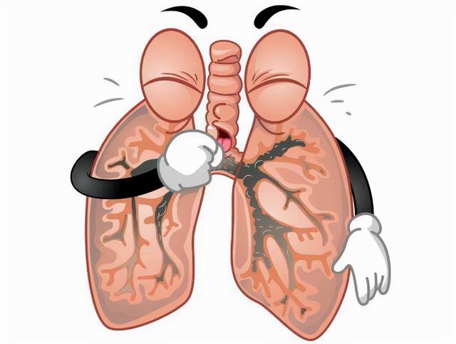 黄痰属热，白痰是寒？中医提醒：咳出4类痰液，多关注肺健康