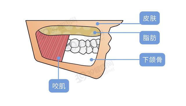 人脸部发腮能瘦回去吗,人脸发腮怎么瘦