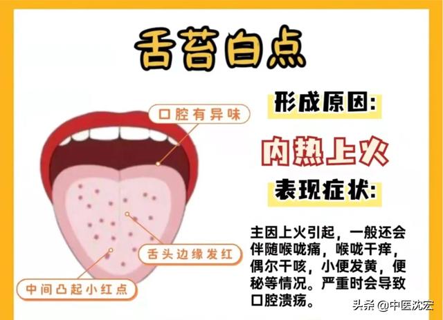 中医：从舌头看健康，舌象分析，常见的6种舌苔问题！和调理建议