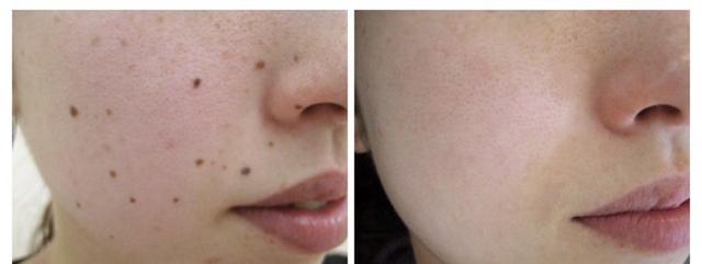 ������Ů���� �������˽ڡ�����Ů���ҽ���ڹ����ݡ�����������е�һҽԺ�ۿ�ҽ����������