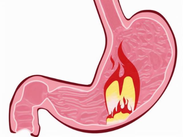 奥美拉唑、兰索拉唑、泮托拉唑、雷贝拉唑有何区别？哪个作用最好