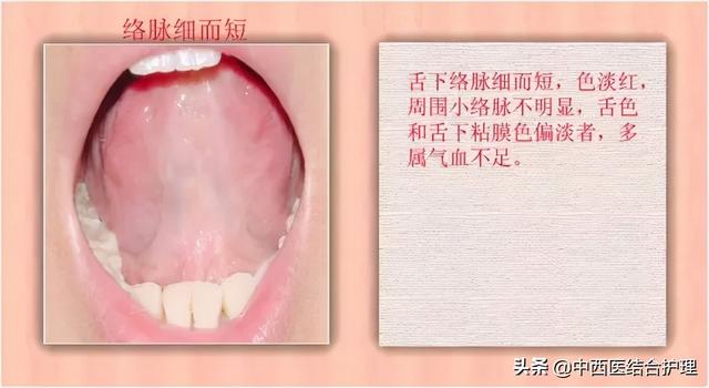 「舌诊科普」中医医生总看舌头都在看什么？奉上珍贵的舌诊图谱
