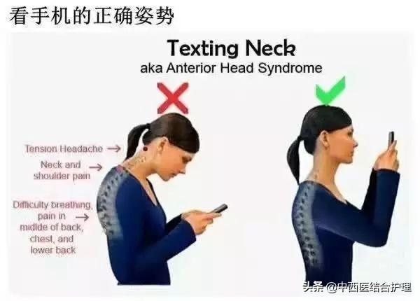 「颈椎养生科普」颈椎曲度变直怎么办？