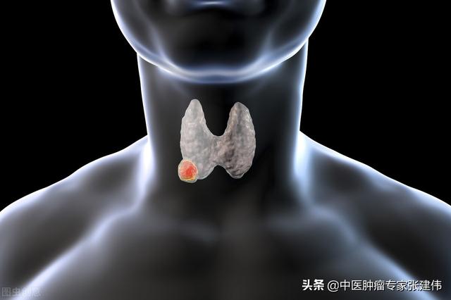 查出甲狀腺結節，就不能吃海鮮嗎？醫生：這些飲食注意事項要牢記