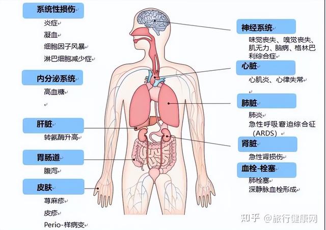 新冠轻度患者也有“后遗症”？调查万余人，这4种症状很常见