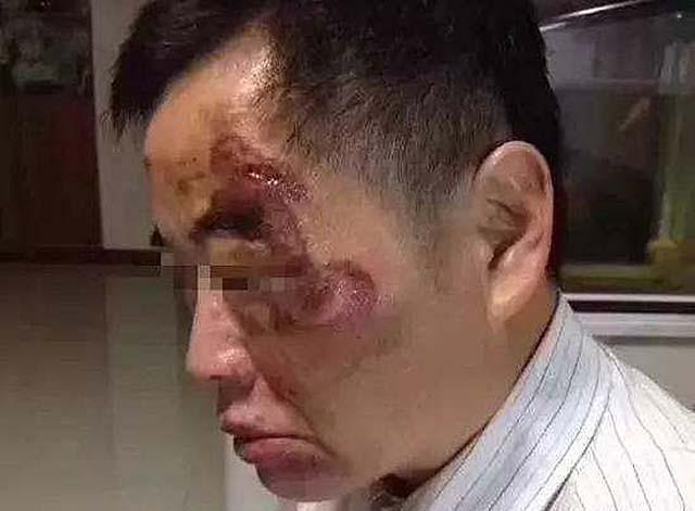 昆山反杀案后续：“龙哥”供职的典当铺被转租，反杀者生活平静