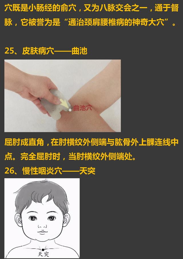 30个常见疾病特效穴位大全，超级实用的中医知识，收藏起来吧