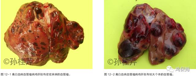 鸡皮肤是不传染