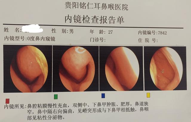 35岁壮年查出鼻咽癌，已做6次化疗！呼吁：这些症状别当成鼻炎