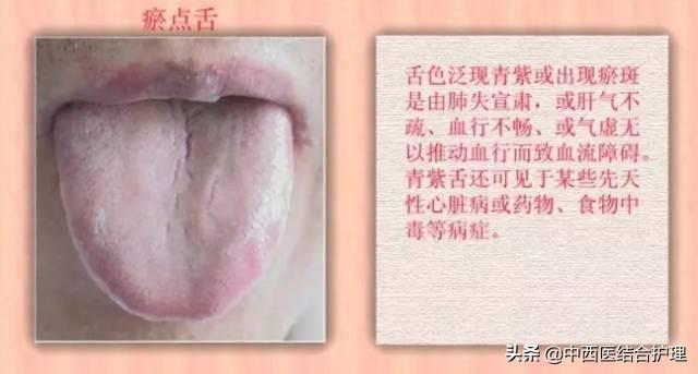 「舌诊科普」中医医生总看舌头都在看什么？奉上珍贵的舌诊图谱