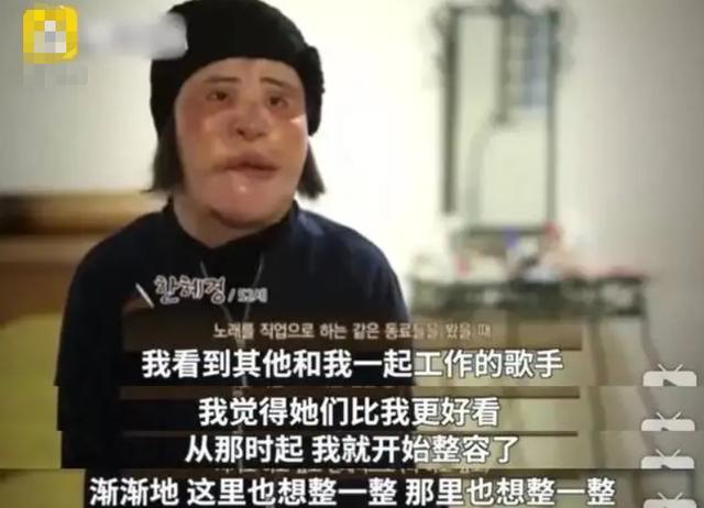 2018年韩慧景去世，年轻时在脸上注射色拉油，因整容过度几乎毁容