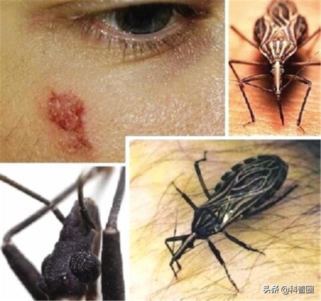 杀人最多的七种动物，第一名蚊子每年致死超72万人，你认识几种-第6张图片-趣闻屋