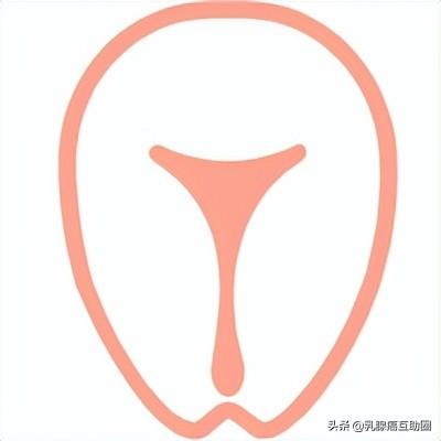 警惕！得了乳腺癌，患其他癌的風險增加20%