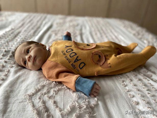 英国宝宝出生时肠子长在体外 已手术成功出院 父母取名“勇士”