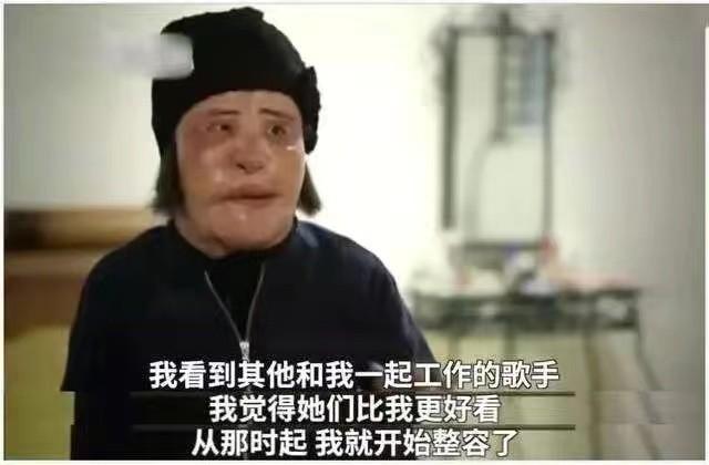 韩慧景：把自己整成“电风扇”，注射食用油代价惨痛，我悔不当初