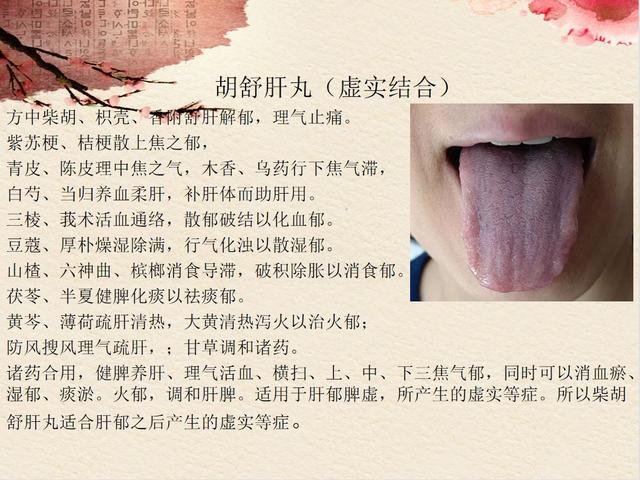 逍遥丸、柴胡舒肝丸、越鞠丸如何通过舌像选？春季养肝秘诀在这里