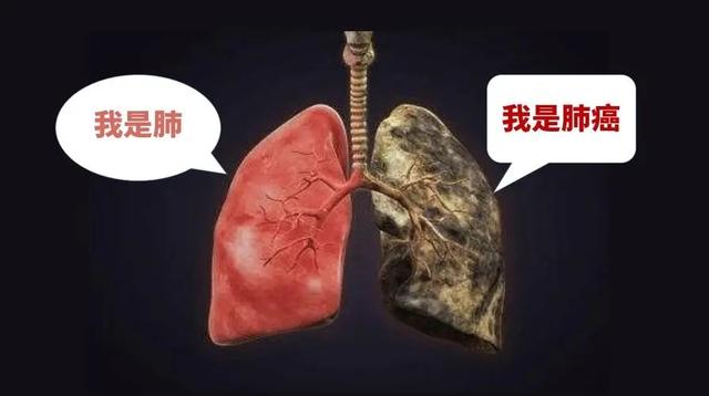 今有肺癌，古有肺积，小小配方四味药，穿越古今疗效好