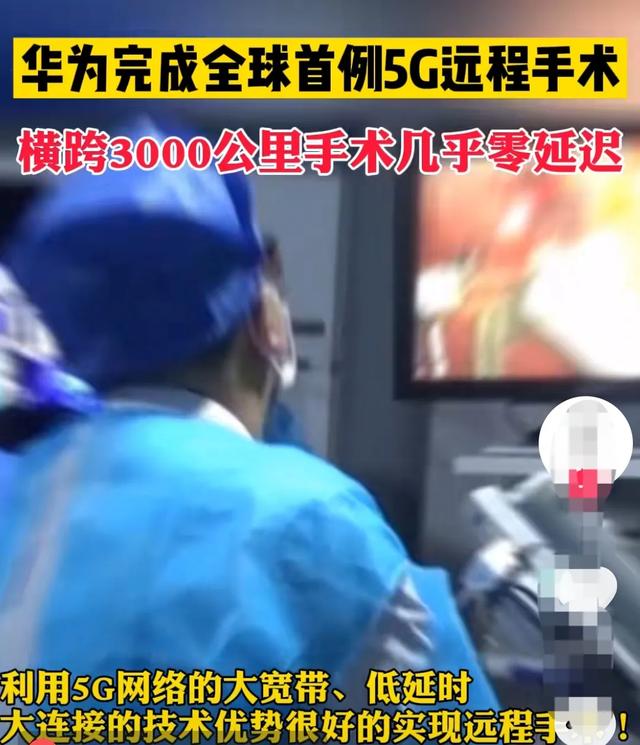 华为5G技术再次领先!完成全球首例5G远程手术:超远距离几乎零延迟-第4张图片-9158手机教程网