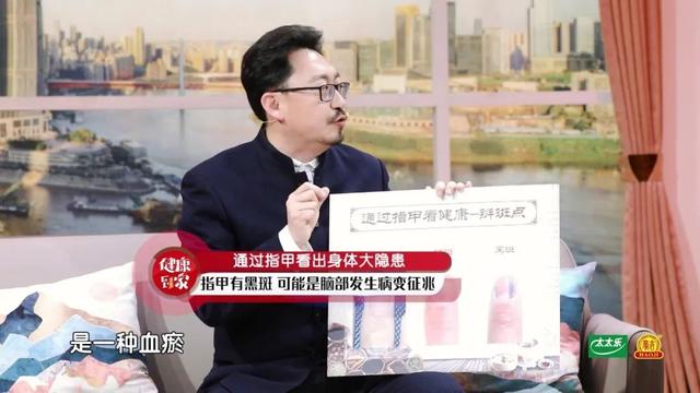 手指甲满足3个特点，多半是身体在“求救”！赶紧自测