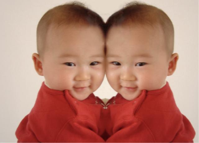 两个大脑指挥一个身躯，真的能保证不吵架吗？连体婴生活大揭秘