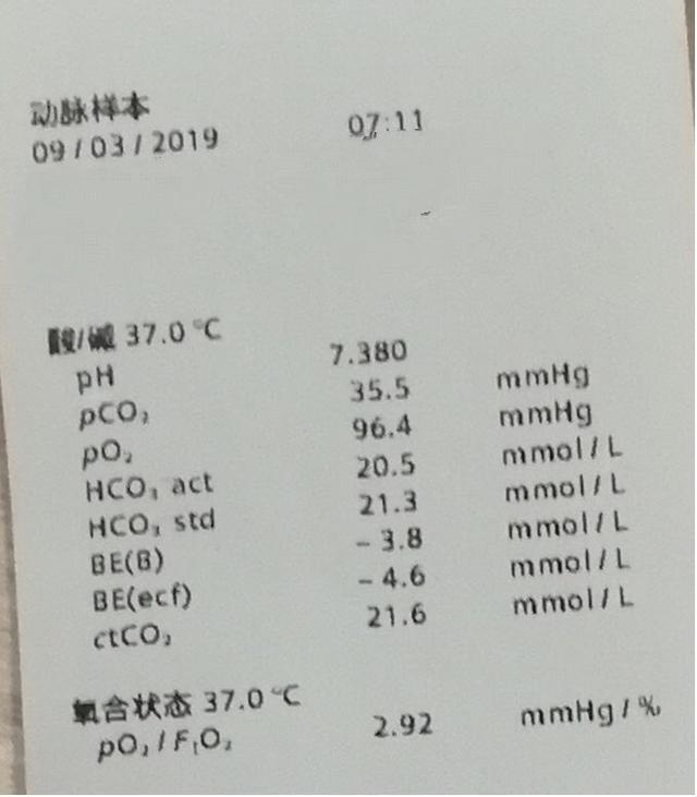 sao2是什么意思