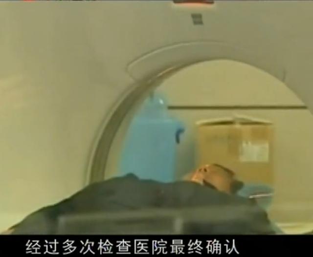 11年云南男子头疼呕吐，身上散发臭味，检查发现脑中插着一把匕首