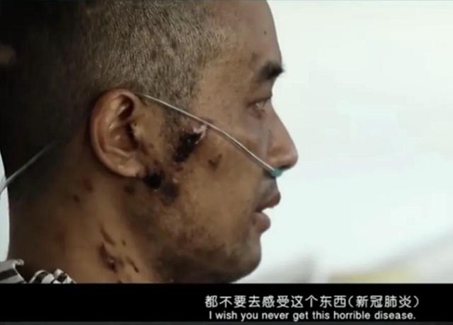 首批新冠幸存者：含泪捐献父亲遗体，20天抢救瘦了40斤