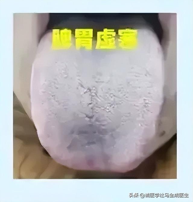 常用调理脾胃的中成药应用大全，不下十几种，看看怎么区分？
