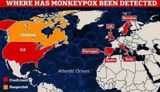 中国40岁以下人群没有免疫力，猴痘病毒来袭，中国这次能挺住吗？