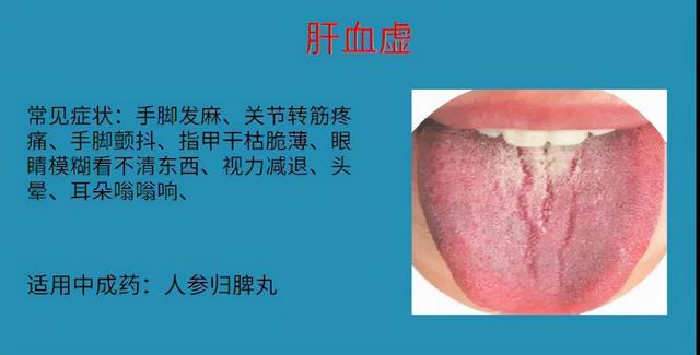 怕冷就补阳？血虚也会！6种血虚情况，实用中成药大总结