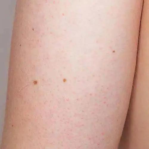 那种去鸡皮的身体乳好 那种去鸡皮的身体乳好