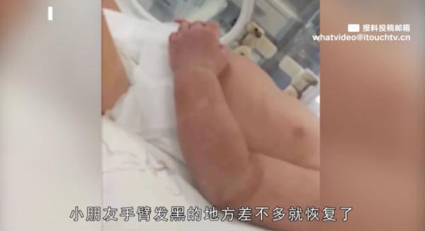 只因宝妈一个疏忽，湖南新生1天婴儿险截肢，这些日用品的危险性千万别忽视