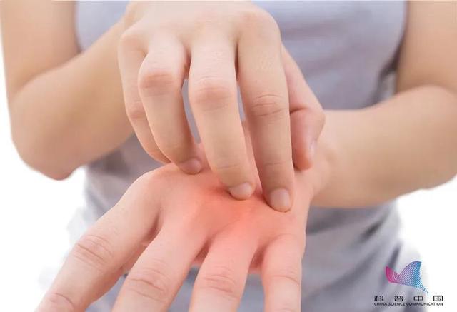 鸡皮肤到冬天红肿又痒