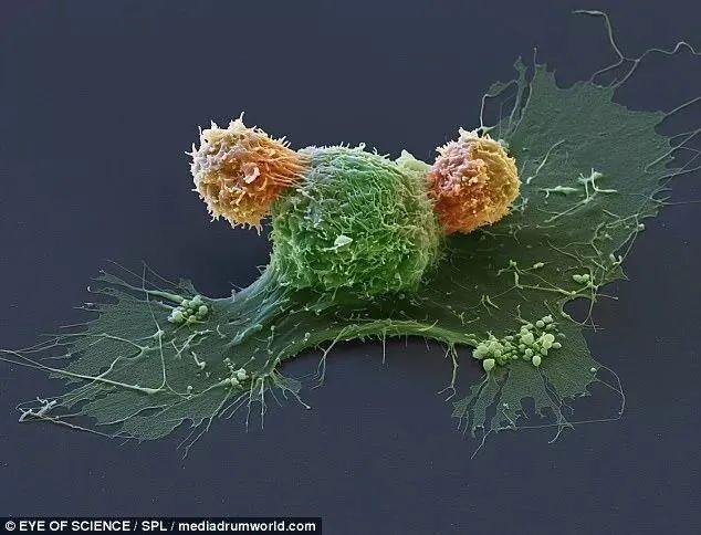 CAR-T细胞是如何工作的？这些图，带你走进"免疫细胞"的世界