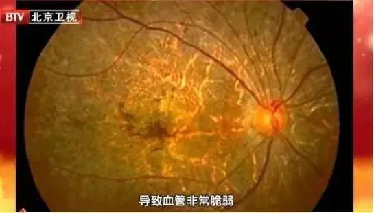 警惕！睡前玩手机会变丑！小心还有这些病找上你……